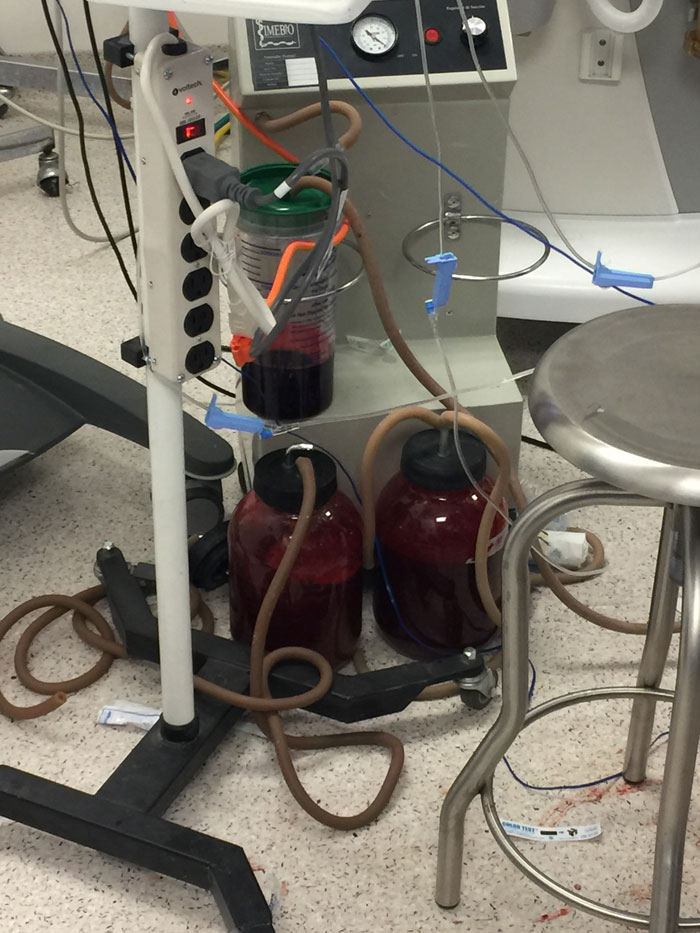 Image of containers of blood