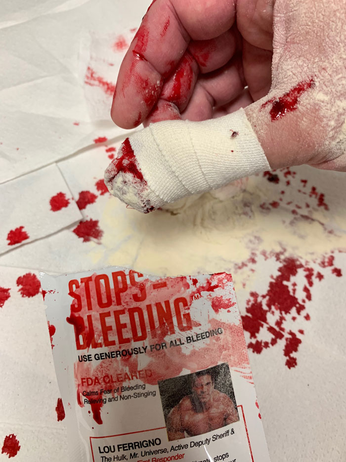Bleeding bandaged thumb with Stops Bleeding™ pouch