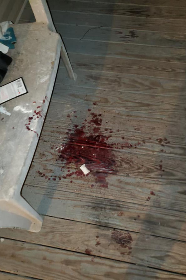 Bloodstain on deck